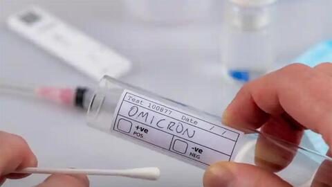 Thủ tướng Chính phủ yêu cầu thông tin chính thức, công khai về kit xét nghiệm