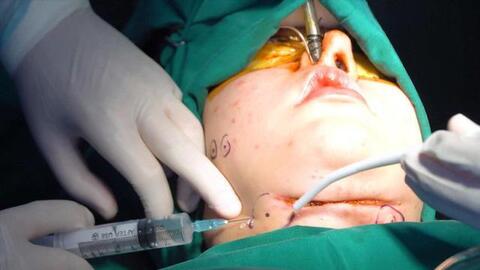 'Thảm họa' tai biến thẩm mỹ