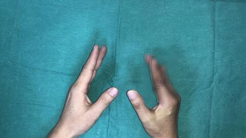 Lần đầu tiên tại Việt Nam: Vi phẫu thuật thành công cứu sống ngón tay thủy thủ bị đứt rời sau 25 giờ