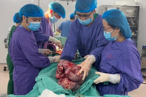 Bệnh viện Ung Bướu Hà Nội: Phẫu thuật khối u tử cung nặng gần 9kg