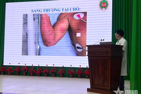 Quân khu 9: Bệnh viện Quân y 121 cứu sống bệnh nhân bị ong vò vẽ đốt 150 vết