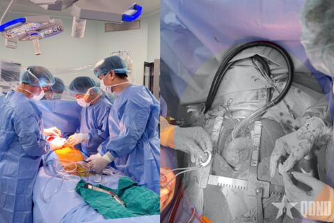 CorHeart 6-hy vọng mới cho bệnh nhân suy tim giai đoạn cuối