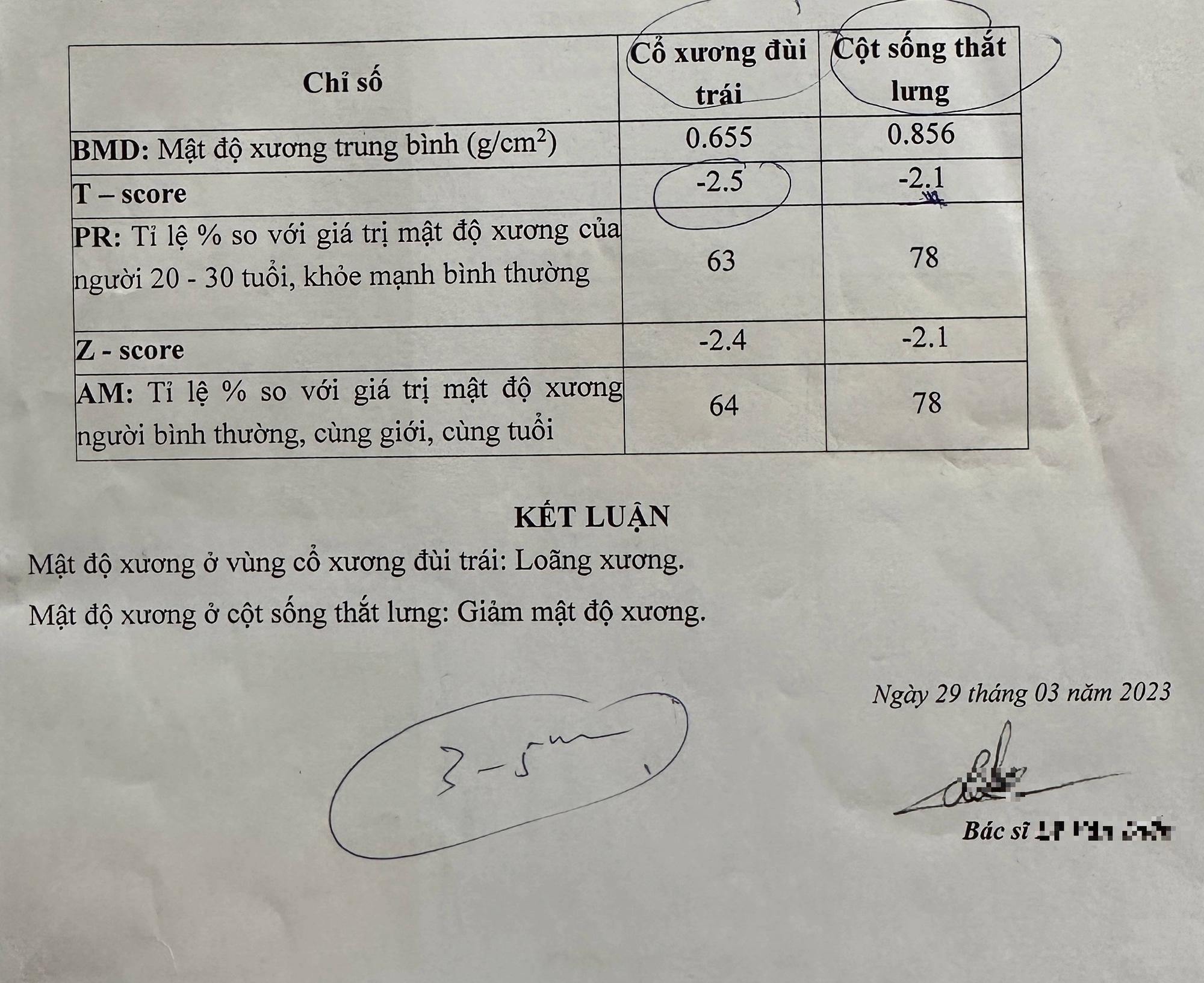 Mới 30 tuổi đã bị loãng xương cấp độ nặng, bác sĩ cảnh báo lối sống người trẻ cần bỏ ngay- Ảnh 2.